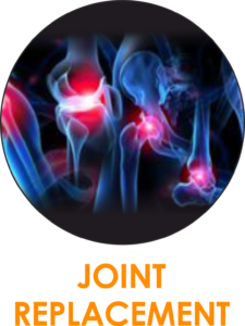 JOINT-replacement