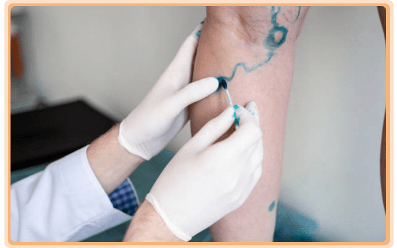 Vascular Surgery