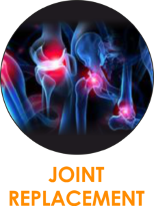 joint-replacement